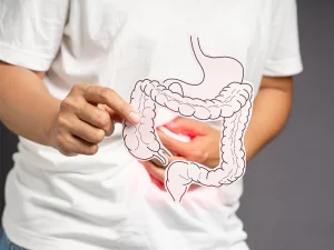 عوارض کولیت زخمی