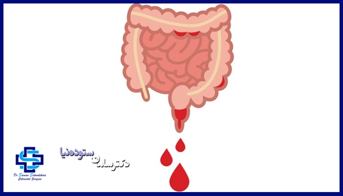 انواع خونریزی دستگاه گوارشی