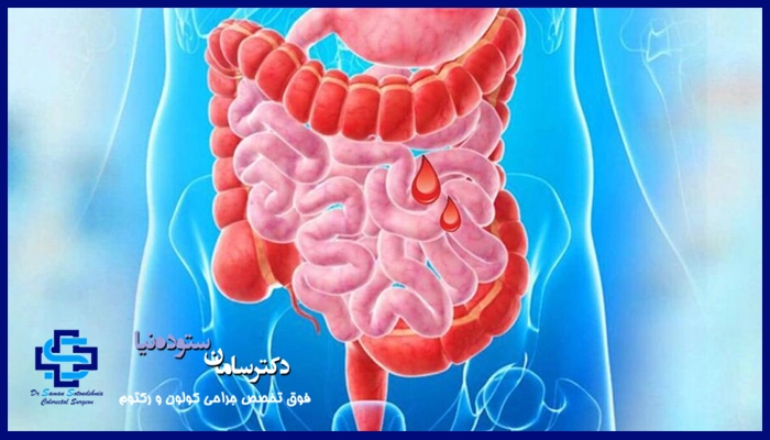 درمان خونریزی روده