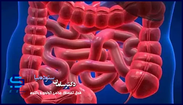 درمان زخم روده