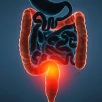 علائم زخم روده