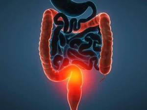 علائم زخم روده